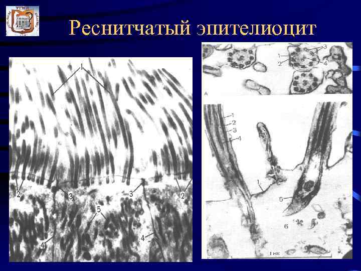 Реснитчатый эпителиоцит 