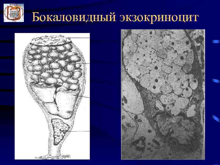 Бокаловидные клетки. Бокаловидная клетка экзокриноцит. Строение бокаловидной клетки. Бокаловидная клетка гистология строение. Бокаловидные экзокриноциты строение.