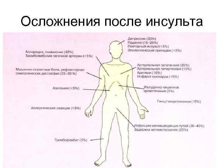 Осложнения после инсульта 