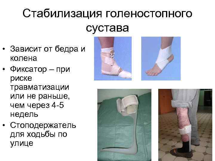 Стабилизация голеностопного сустава • Зависит от бедра и колена • Фиксатор – при риске