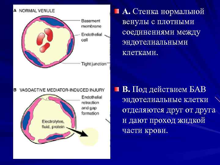 A. Стенка нормальной венулы с плотными соединениями между эндотелиальными клетками. B. Под действием БАВ