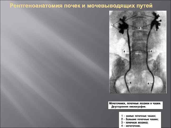 Рентгеноанатомия почек и мочевыводящих путей 