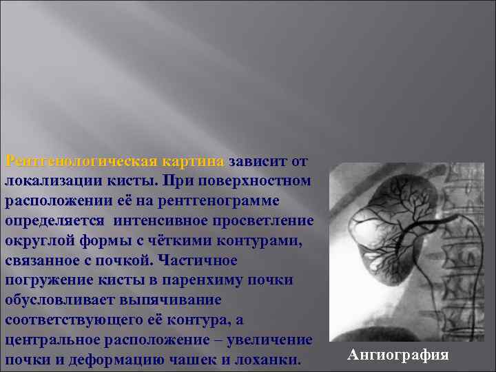 Рентгенологическая картина зависит от локализации кисты. При поверхностном расположении её на рентгенограмме определяется интенсивное