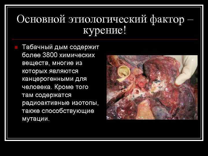 Основной этиологический фактор – курение! n Табачный дым содержит более 3800 химических веществ, многие