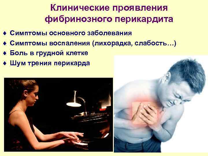 Клинические проявления фибринозного перикардита ¨ ¨ Симптомы основного заболевания Симптомы воспаления (лихорадка, слабость…) Боль