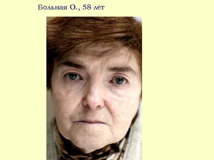 Больная О. , 58 лет 