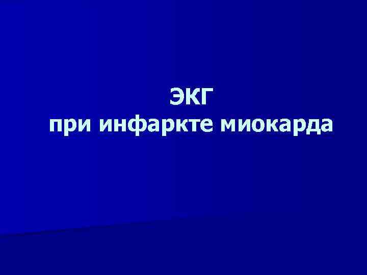 ЭКГ при инфаркте миокарда 