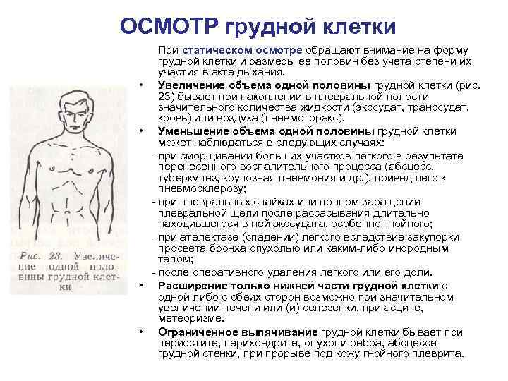 ОСМОТР грудной клетки При статическом осмотре обращают внимание на форму грудной клетки и размеры