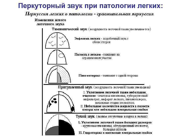 Перкуторный звук при патологии легких: 