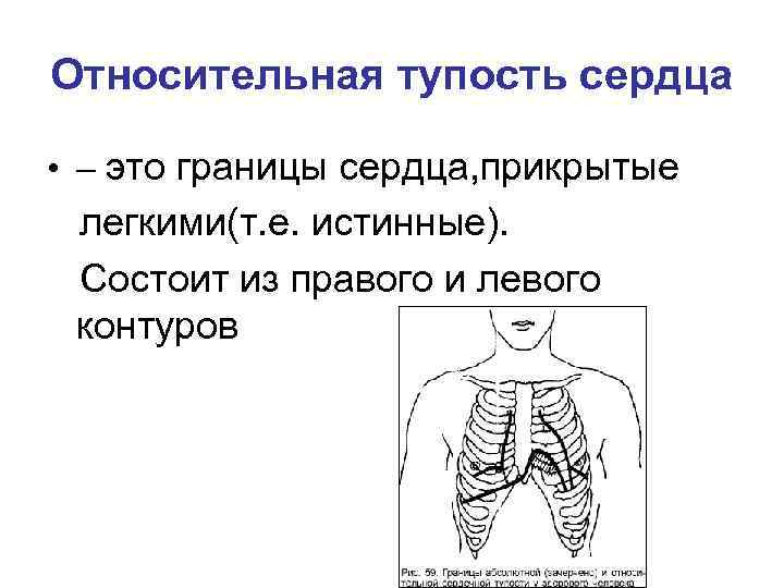 Относительная тупость сердца • – это границы сердца, прикрытые легкими(т. е. истинные). Состоит из