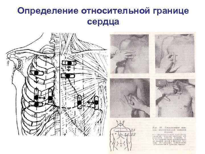 Определение относительной границе сердца 