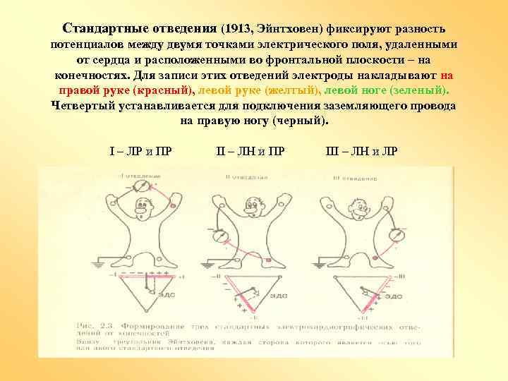 Стандартные отведения (1913, Эйнтховен) фиксируют разность потенциалов между двумя точками электрического поля, удаленными от