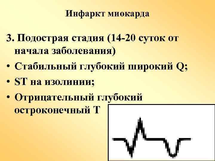 Инфаркт миокарда 3. Подострая стадия (14 -20 суток от начала заболевания) • Стабильный глубокий