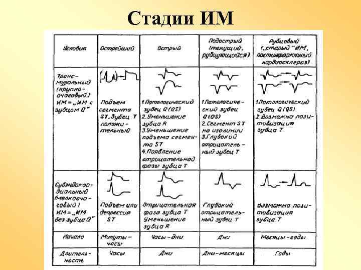 Стадии ИМ 