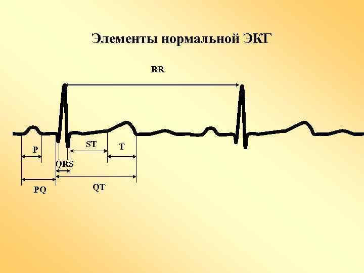 Элементы нормальной ЭКГ RR ST P QRS PQ QT T 