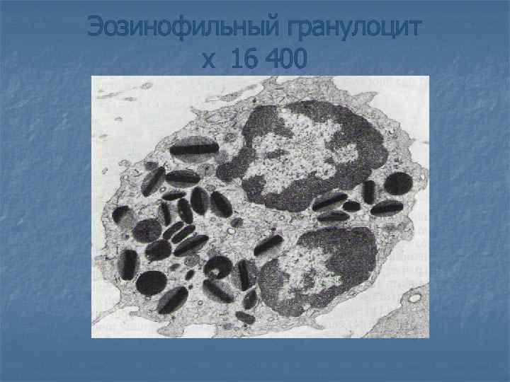 Эозинофильный гранулоцит х 16 400 