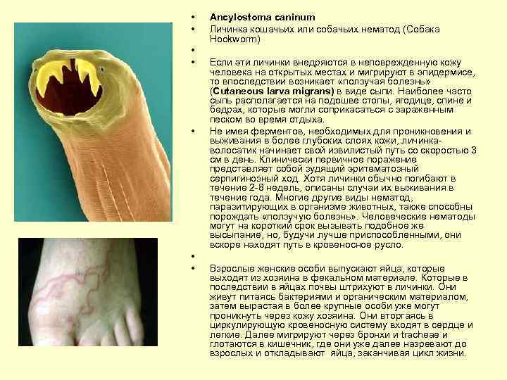  • • Ancylostoma caninum Личинка кошачьих или собачьих нематод (Собака Hookworm) Если эти