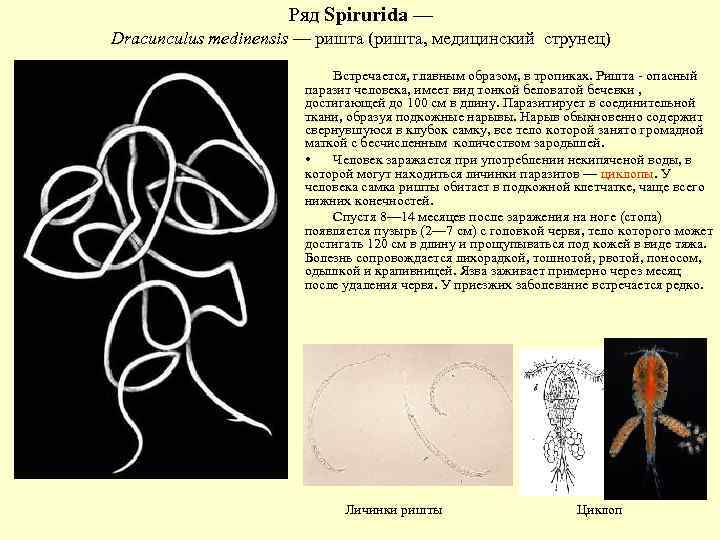 Ряд Spirurida — Dracunculus medinensis — ришта (ришта, медицинский струнец) Встречается, главным образом, в