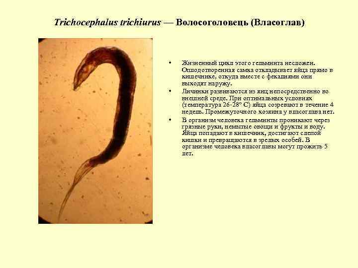 Trichocephalus trichiurus — Волосоголовець (Власоглав) • • • Жизненный цикл этого гельминта несложен. Оплодотворенная