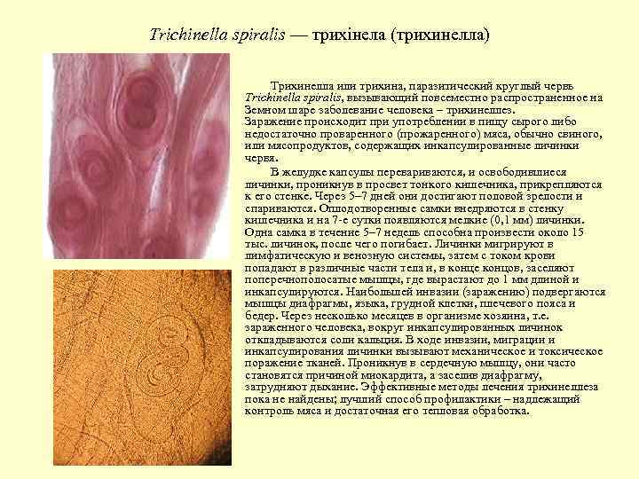 Trichinella spiralis — трихінела (трихинелла) Трихинелла или трихина, паразитический круглый червь Trichinella spiralis, вызывающий