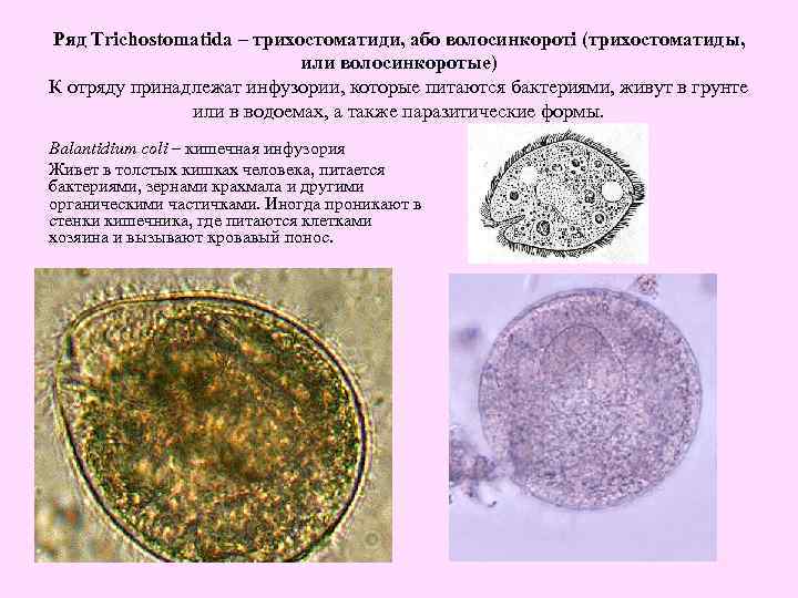 Ряд Trichostomatida – трихостоматиди, або волосинкороті (трихостоматиды, или волосинкоротые) К отряду принадлежат инфузории, которые