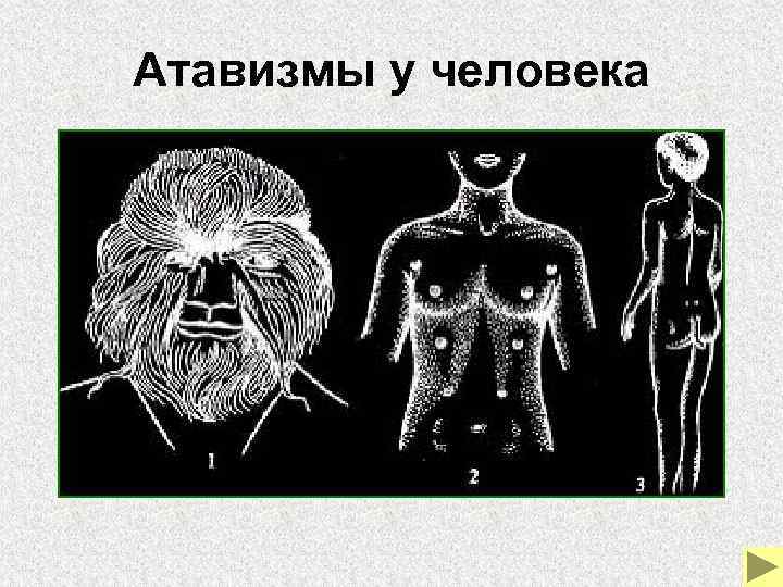 Атавизмы у человека 