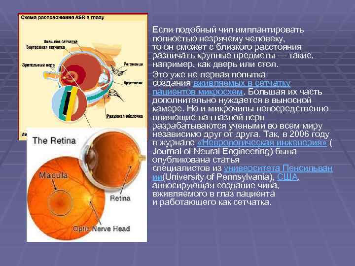 § Если подобный чип имплантировать полностью незрячему человеку, то он сможет с близкого расстояния