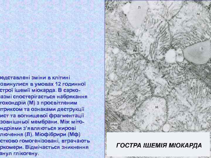 редставлені зміни в клітині озвинулися в умовах 12 годинної строї ішемії міокарда. В сарколазмі