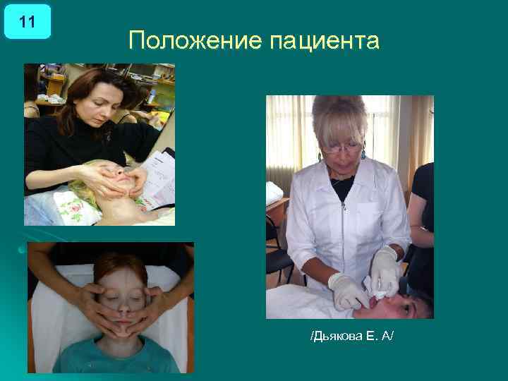 11 Положение пациента /Дьякова Е. А/ 
