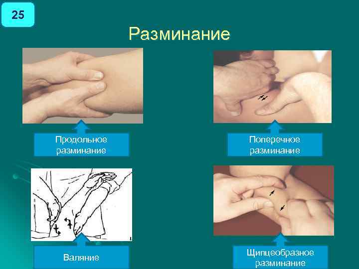 25 Разминание Продольное разминание Валяние Поперечное разминание Щипцеобразное разминание 