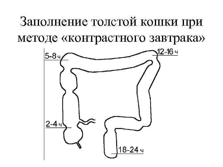 Заполнение толстой кошки при методе «контрастного завтрака» 