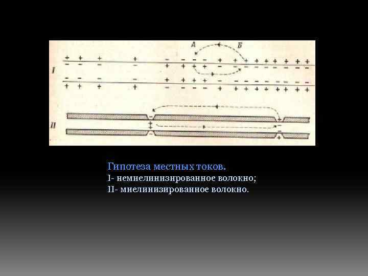 Гипотеза местных токов. Ι- немиелинизированное волокно; ΙΙ- миелинизированное волокно. 