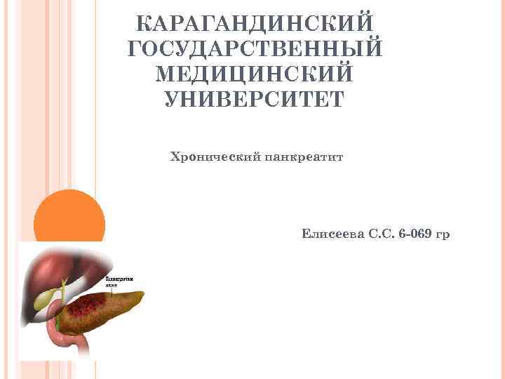 КАРАГАНДИНСКИЙ ГОСУДАРСТВЕННЫЙ МЕДИЦИНСКИЙ УНИВЕРСИТЕТ Хронический панкреатит Елисеева С. С. 6 -069 гр 