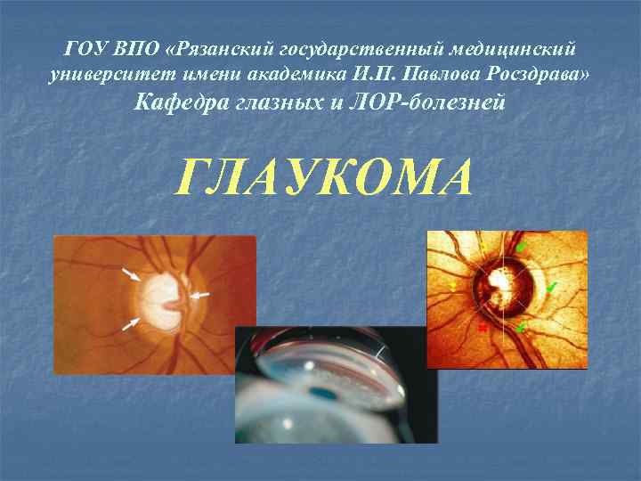 ГОУ ВПО «Рязанский государственный медицинский университет имени академика И. П. Павлова Росздрава» Кафедра глазных