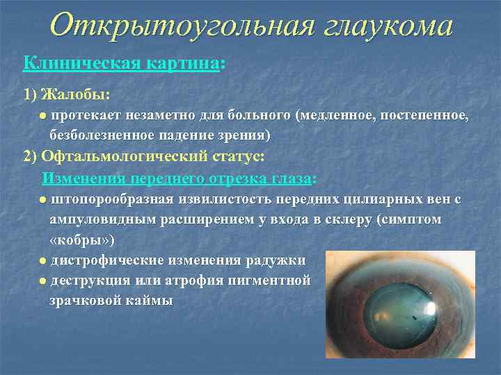 Открытоугольная глаукома Клиническая картина: 1) Жалобы: ● протекает незаметно для больного (медленное, постепенное, безболезненное