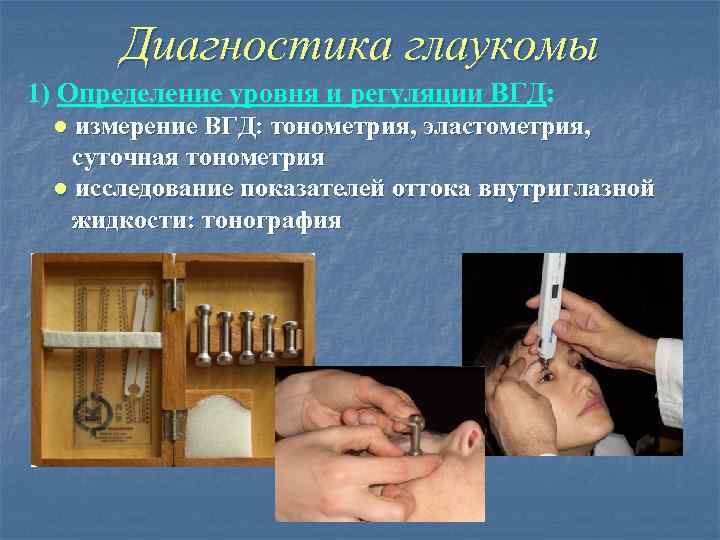 Диагностика глаукомы 1) Определение уровня и регуляции ВГД: ● измерение ВГД: тонометрия, эластометрия, суточная