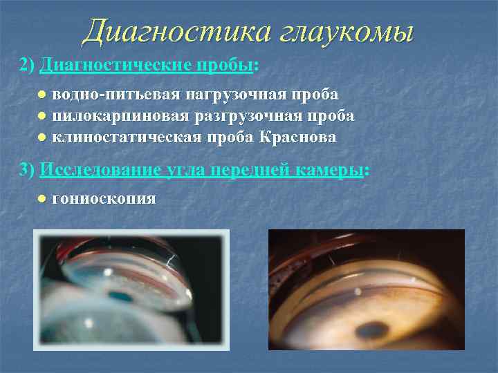 Диагностика глаукомы 2) Диагностические пробы: ● водно-питьевая нагрузочная проба ● пилокарпиновая разгрузочная проба ●