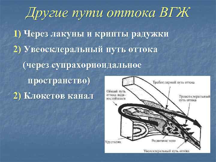 Другие пути оттока ВГЖ 1) Через лакуны и крипты радужки 2) Увеосклеральный путь оттока