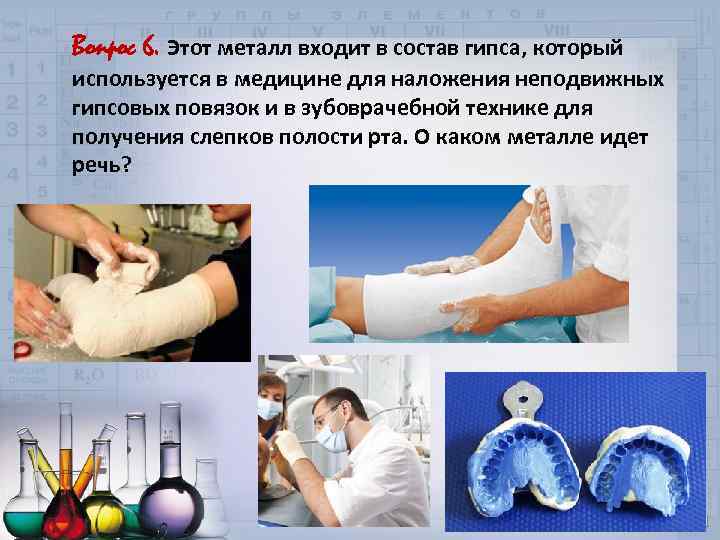 Вопрос 6. Этот металл входит в состав гипса, который используется в медицине для наложения