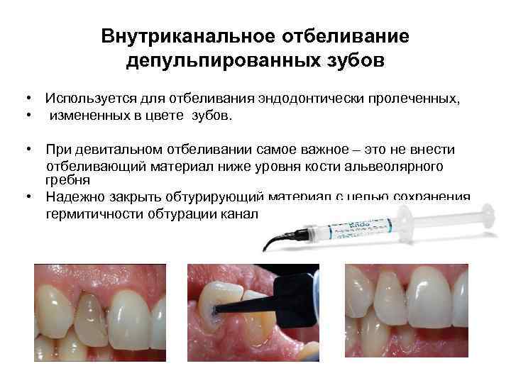 Внутриканальное отбеливание депульпированных зубов • Используется для отбеливания эндодонтически пролеченных, • измененных в цвете
