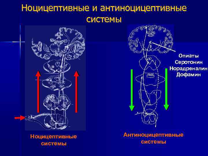 Центральные механизмы ноцицепции презентация