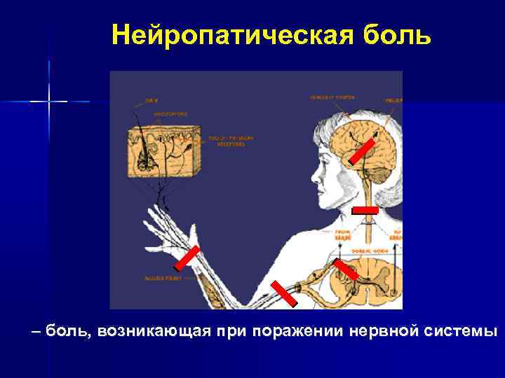 Рисунки по неврологии