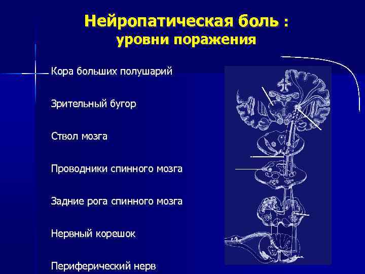 Нейропатическая боль : уровни поражения Кора больших полушарий Зрительный бугор Ствол мозга Проводники спинного
