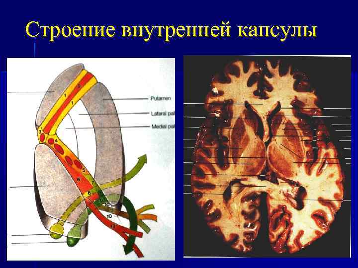 Внутренняя капсула