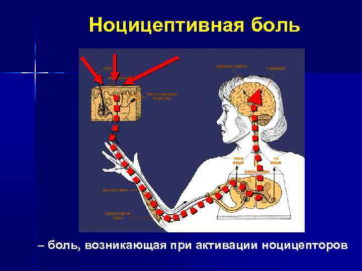 Ноцицептивная система