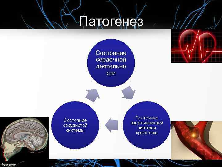 Патогенез Состояние сердечной деятельно сти Состояние сосудистой системы Состояние свертывающей системы кровотока 