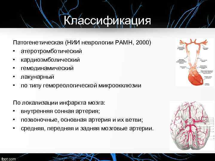 Классификация Патогенетическая (НИИ неврологии РАМН, 2000) • атеротромботический • кардиоэмболический • гемодинамический • лакунарный