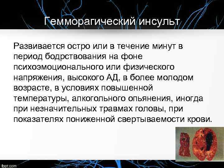 Гемморагический инсульт Развивается остро или в течение минут в период бодрствования на фоне психоэмоционального