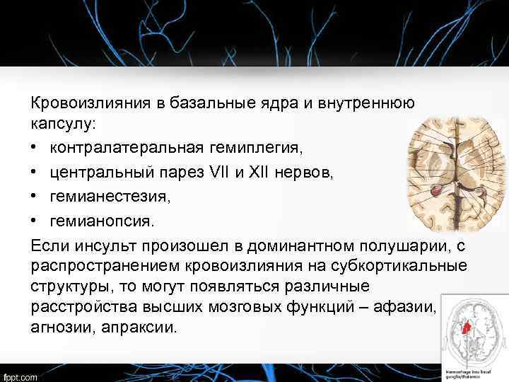 Кровоизлияния в базальные ядра и внутреннюю капсулу: • контралатеральная гемиплегия, • центральный парез VII