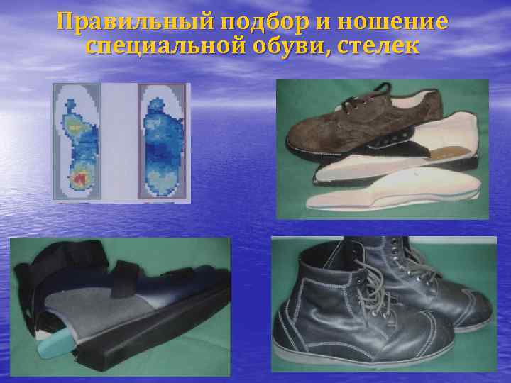 Правильный подбор и ношение специальной обуви, стелек 